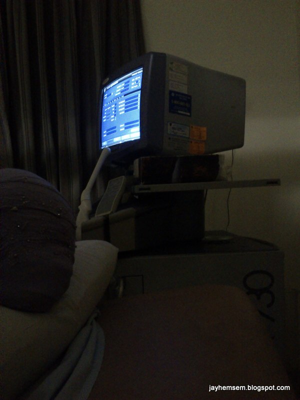 JayHemSem: Baby Ultrasound Scan di Klinik Bersalin PPUM