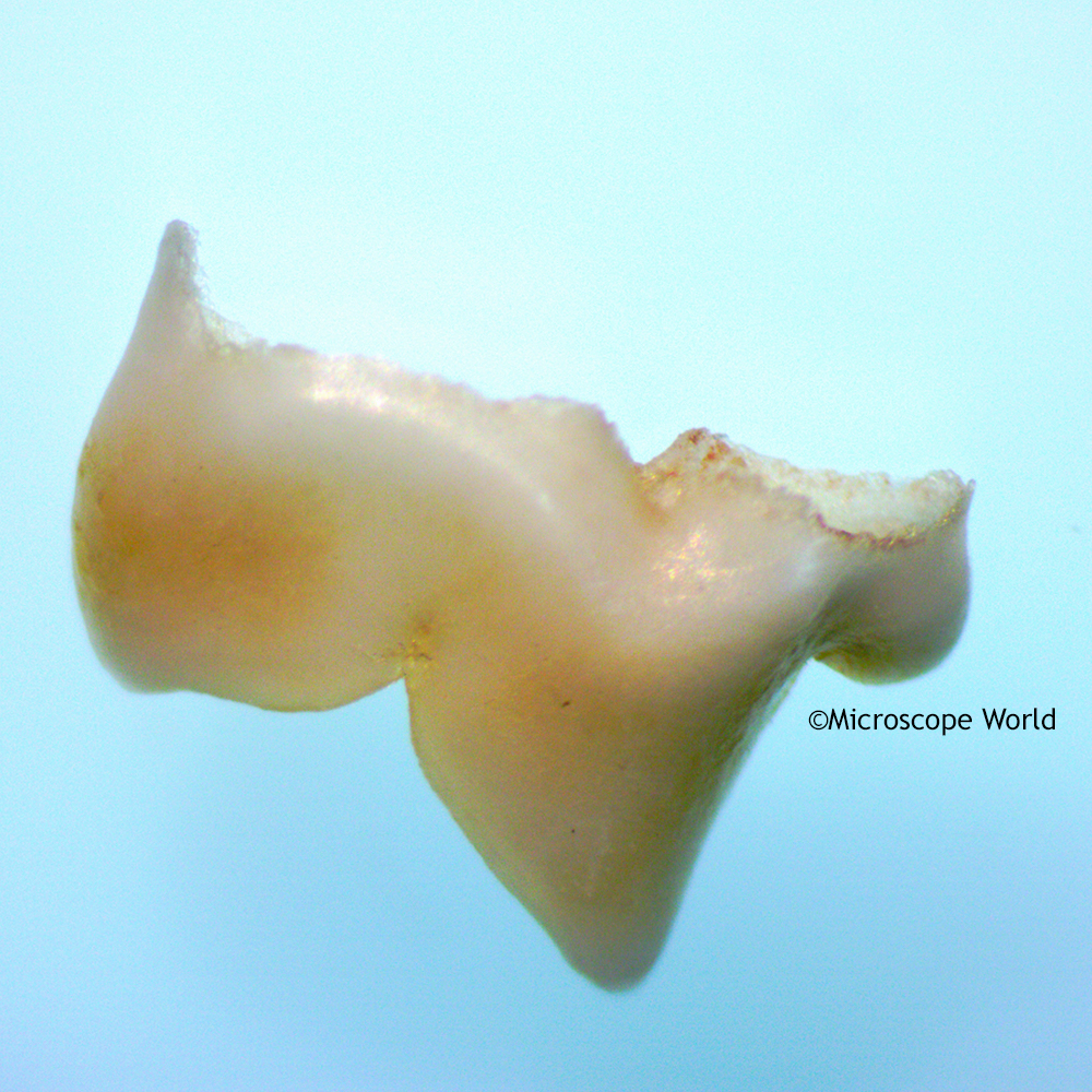 Microscope World Blog Kitten Baby Tooth Under the Microscope