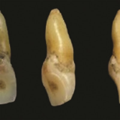 Exploring the prehistory of Palawan Island through human remains Exploring the prehistory of Palawan Island through human remains