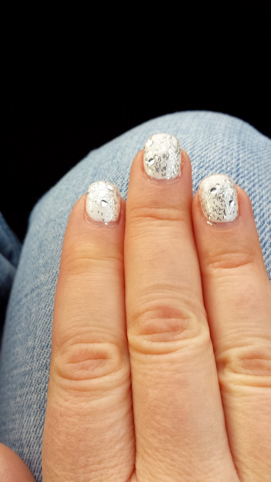 The Table New Bump on Knuckle + Eye Twitching (Myokymia)