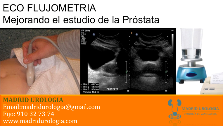 eco prostatico que es el eco prostatico que es el