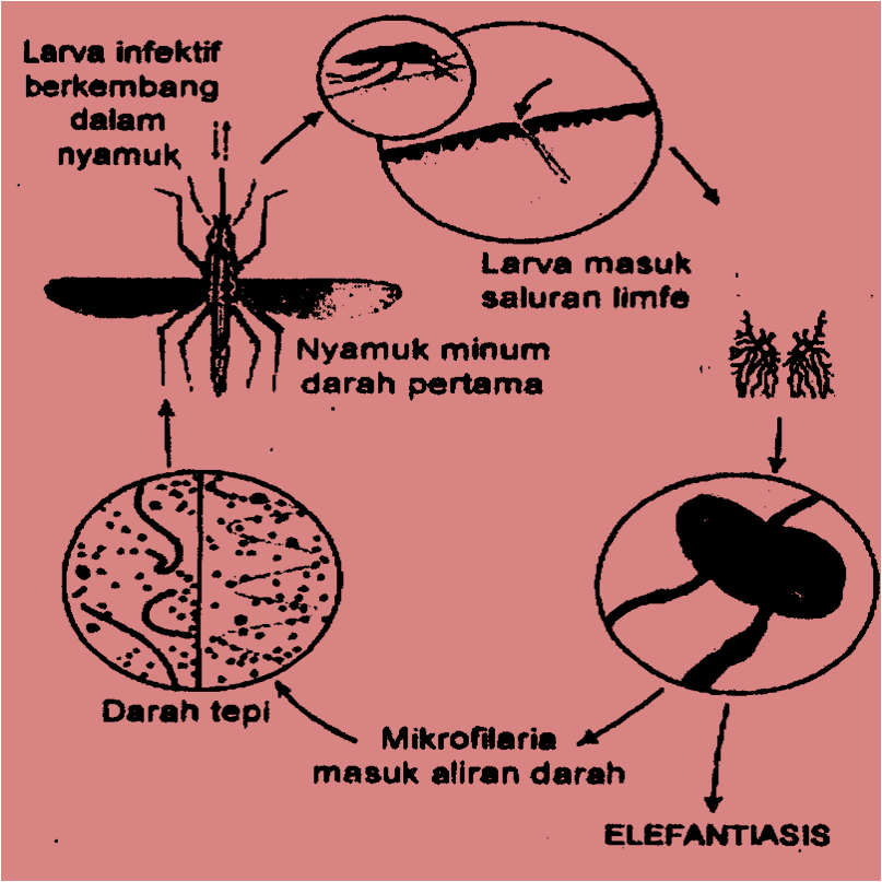 Gambar gejala penyakit malaria