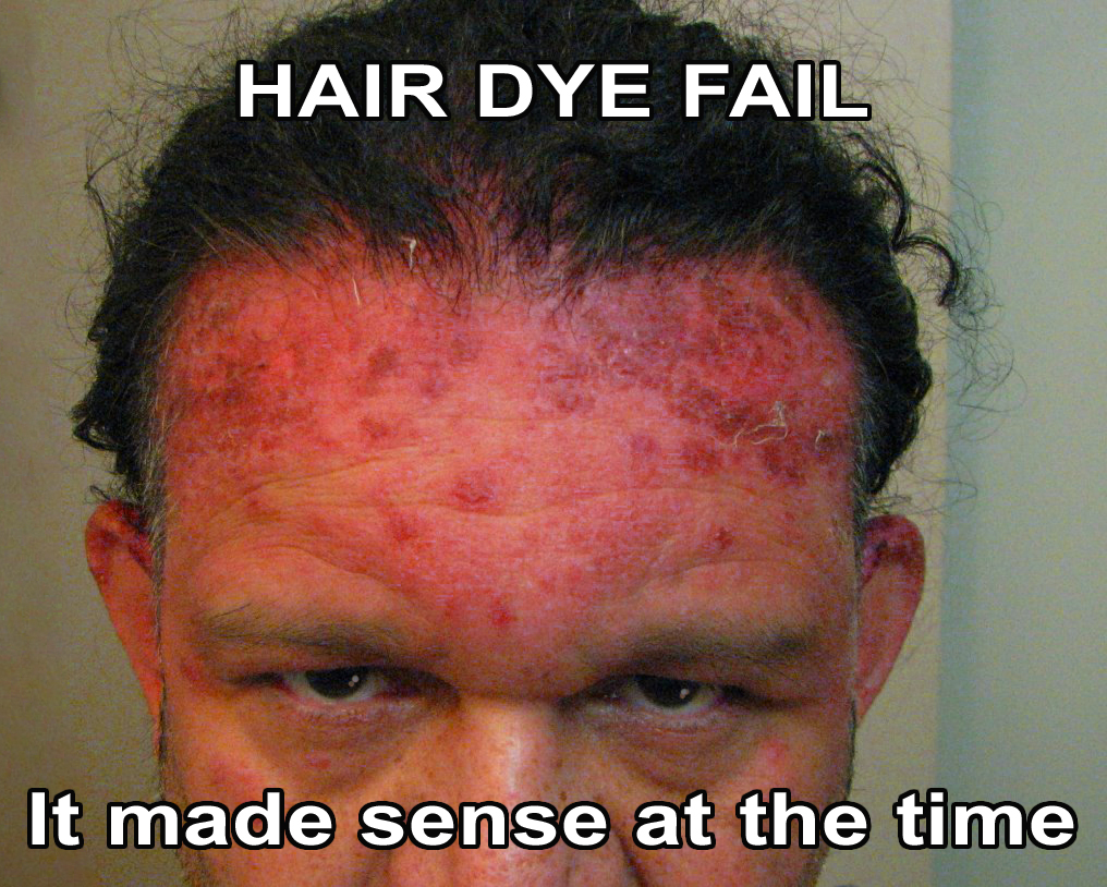 Dangerous Hair Dye