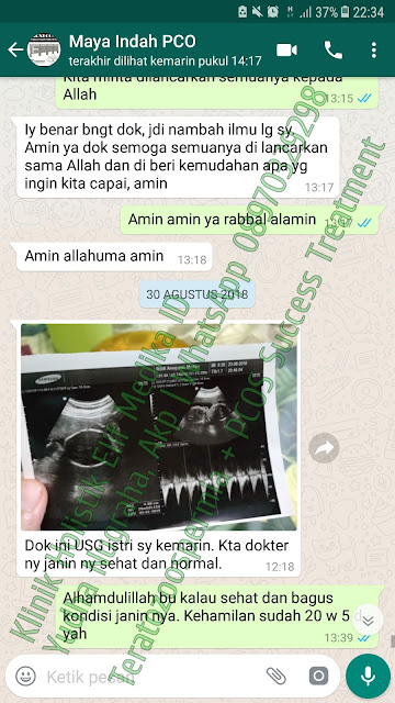 pcos pcos bisa hamil