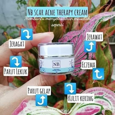 nb acne scar cream
