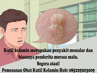 Obat kutil kelamin Obat kutil kelamin
