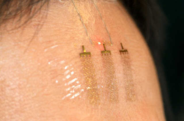 tattoo that uses electrodes