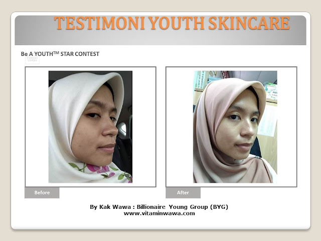 34 Testimoni Youth Skincare Shaklee Terbaru, Youth skincare shaklee, testimoni youth skincare shaklee, Youth Skincare Shaklee : Harga dan Review Pengguna Youth Shaklee, testimoni youth skincare shaklee, testimoni youth skincare shaklee 34 Testimoni Youth Skincare Shaklee Terbaru, Youth skincare shaklee, testimoni youth skincare shaklee, Youth Skincare Shaklee : Harga dan Review Pengguna Youth Shaklee, testimoni youth skincare shaklee, testimoni youth skincare shaklee