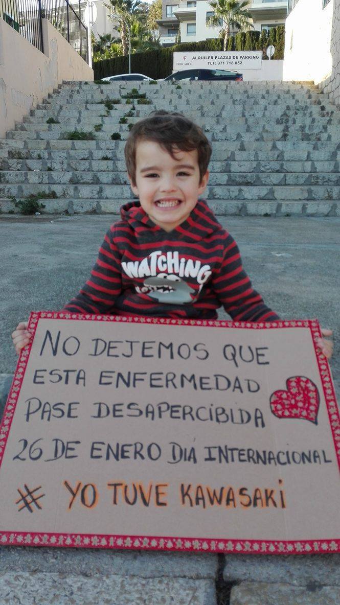 enfermedad kawasaki se puede curar