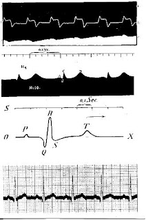 inicios de los electrocardiogramas 100