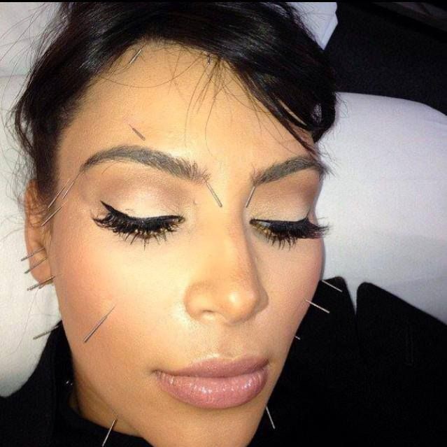 How Ear acupuncture for weight loss works How Diets Work Blog