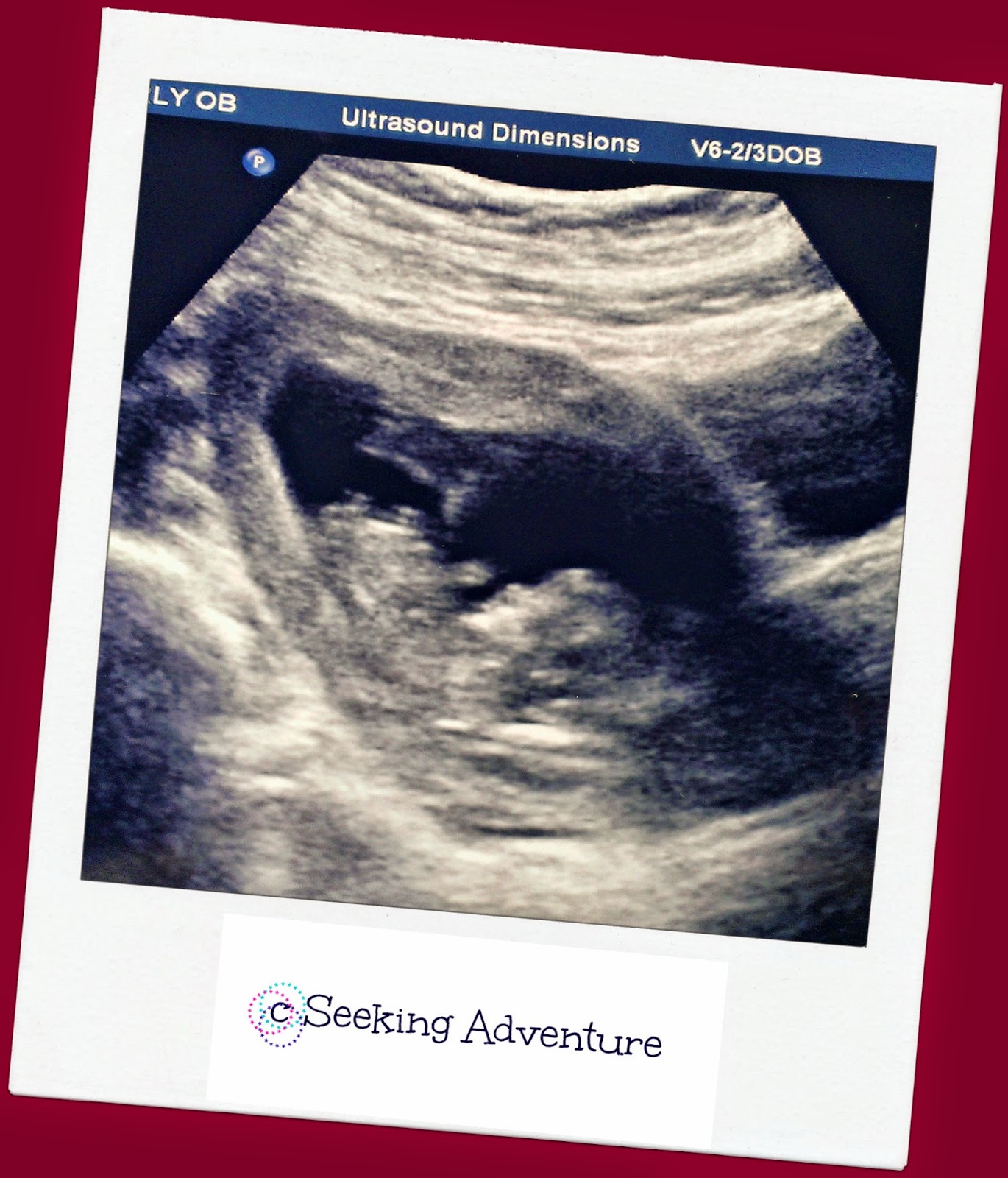 Seeking adventure The Ultrasound Baby's first picture