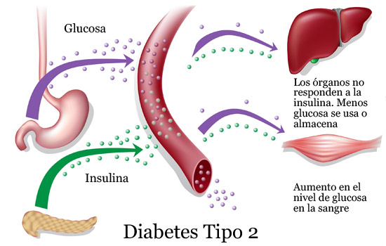 dejarlo 44 diabetes revertida