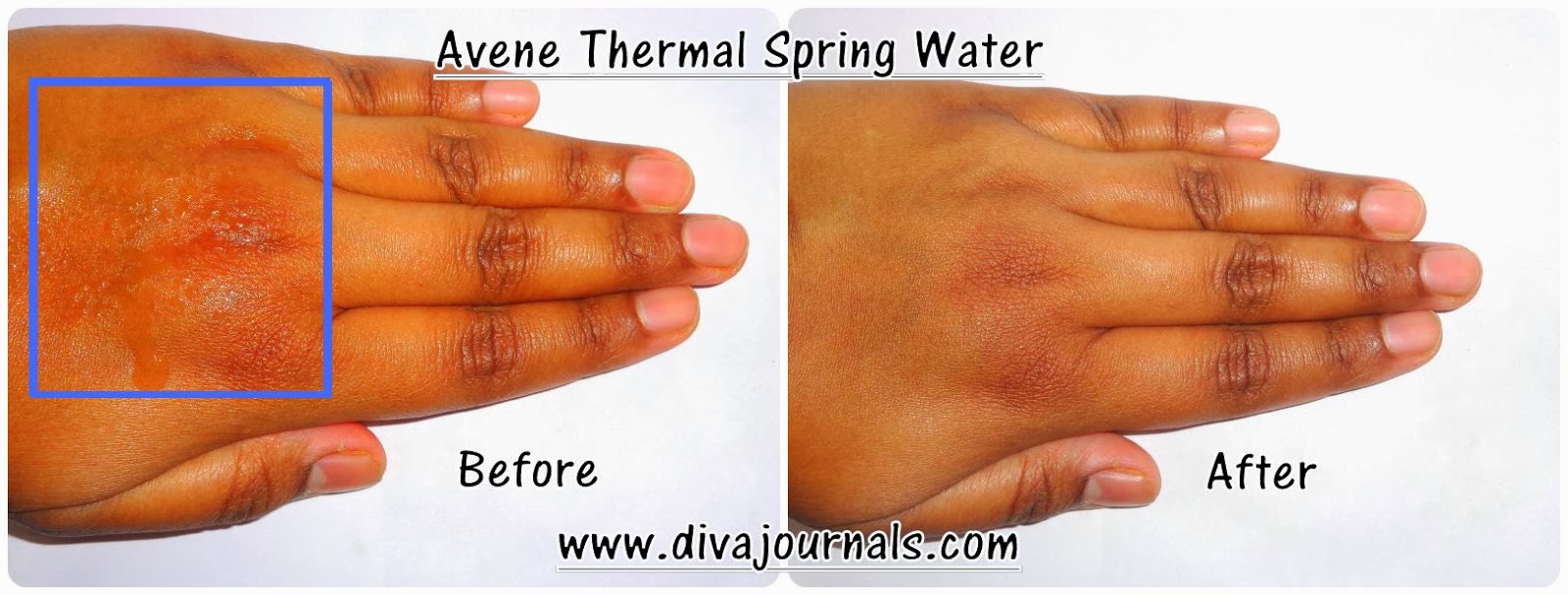 Image result for avene thermal water review
