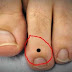 உங்க கால் விரல் இப்படி இருக்கா?