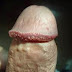 Obat Alami Kutil Kelamin Pada Wanita thumbnail