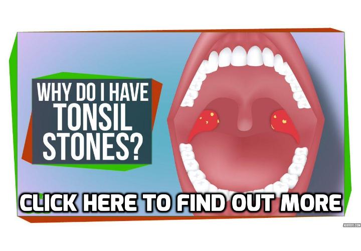 How To Have a Healthy Life Are there Any Link between and