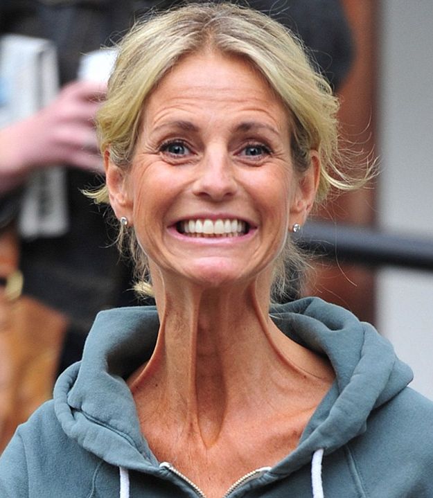 Facial Yoga Regenerate Your Face Skin For A NonSurgical Facelift