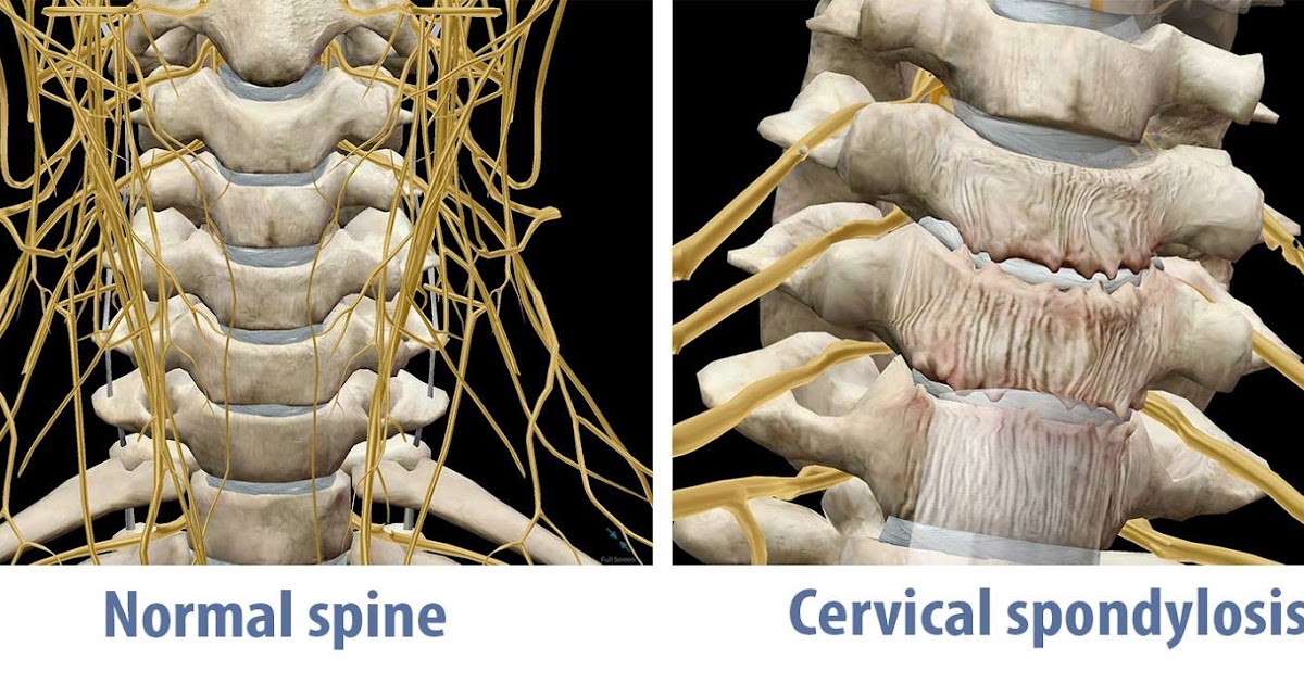 Cervical acupuncture points