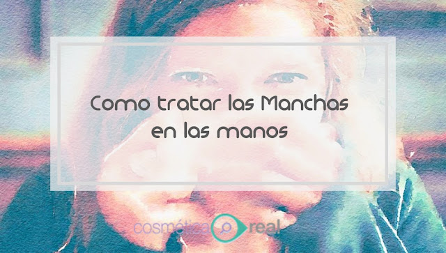 Como tratar las manchas en las manos