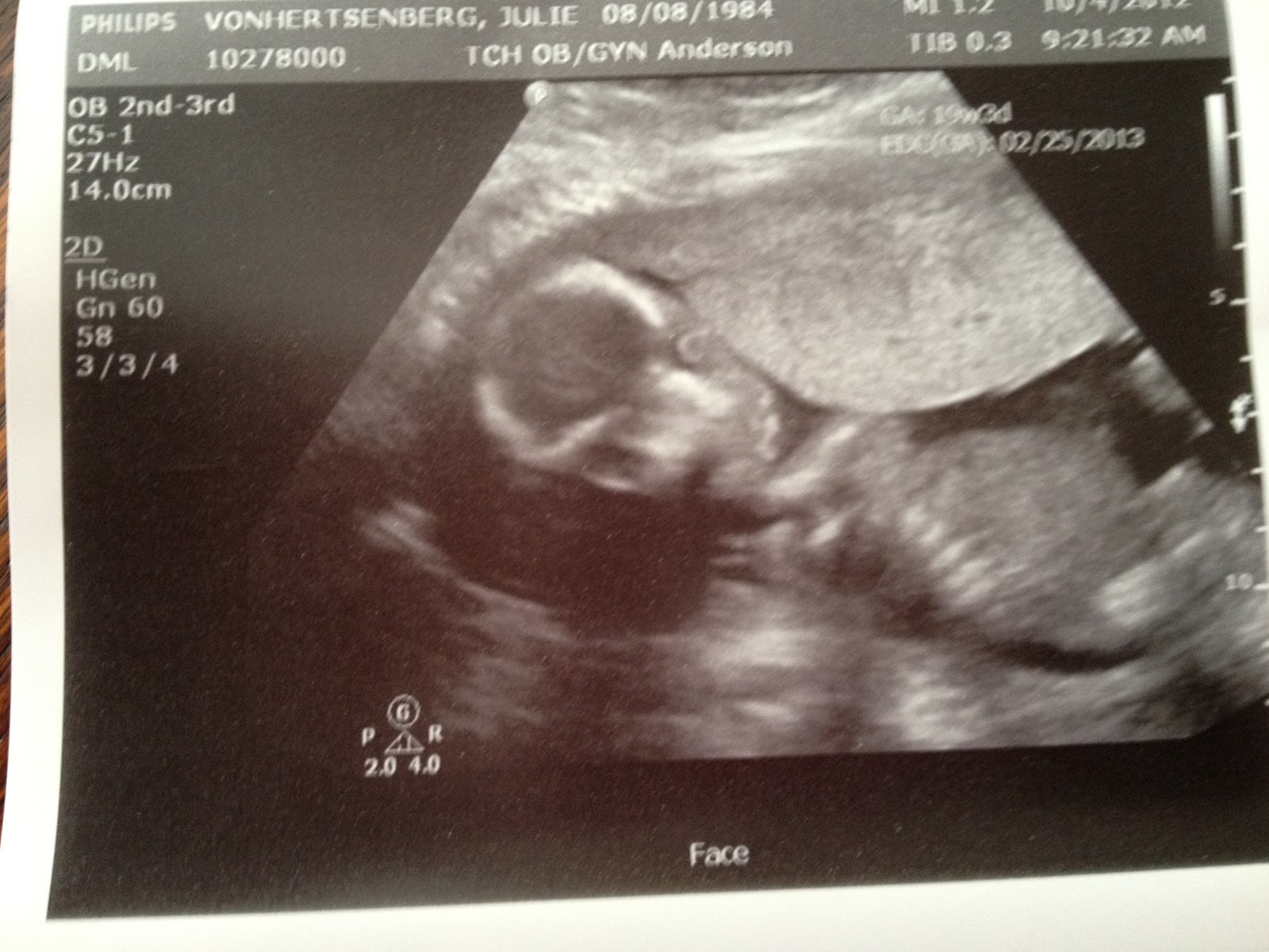 Our family journey it s a girl ultrasound pictures 19 weeks 3 days