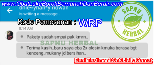 Cara Alami Menghilangkan Bopeng Bekas Jerawat Di Wajah Sampai Tuntas Cara Alami Menghilangkan Bopeng Bekas Jerawat Di Wajah Sampai Tuntas