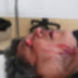 HOMBRE PIERDE EL OJO DERECHO EN PELEA CALLEJERA