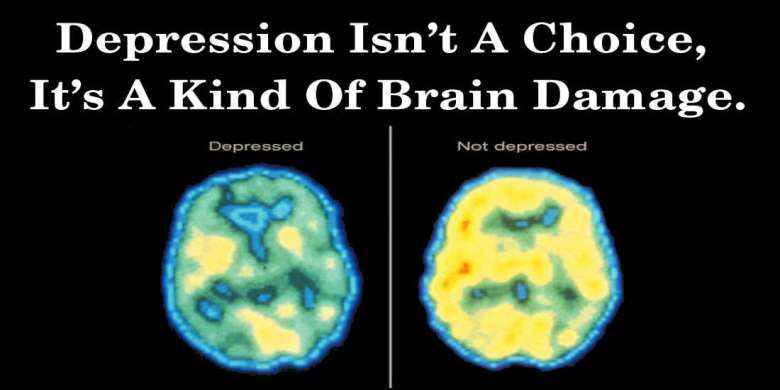 Depression Isn’t A Choice, It’s A Kind Of Brain Damage
