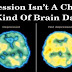 Depression Isn’t A Choice, It’s A Kind Of Brain Damage