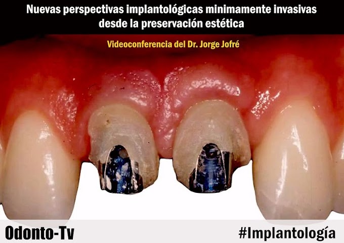 WEBINAR: Cirugía mínimamente invasiva desde la preservación estética - Dr. Jorge Jofré