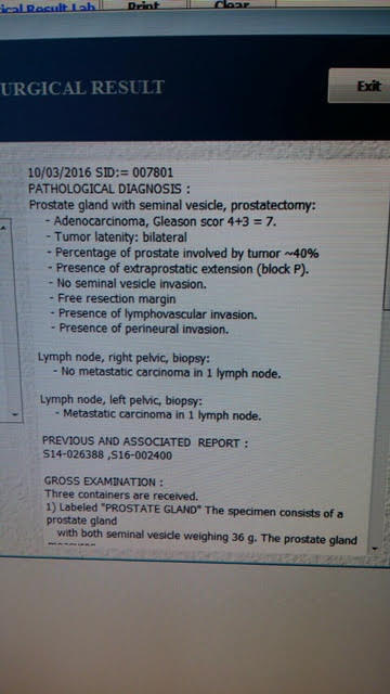 psa 4.2 prostata