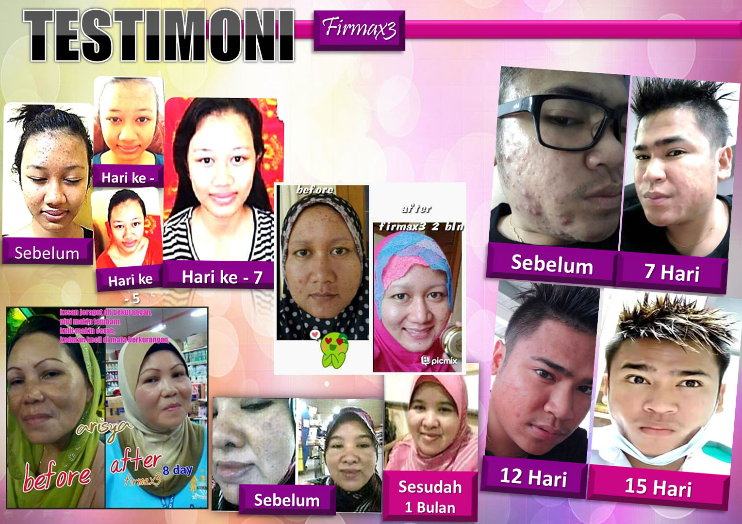 Testimoni Firmax3 Cream Indonesia