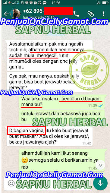 Obat Benjolan Di Sekitar Kemaluan Wanita ini TERBUKTI AMPUH Menyembuhkan Benjolan Di Sekitar Kemaluan Obat Benjolan Di Sekitar Kemaluan Wanita ini TERBUKTI AMPUH Menyembuhkan Benjolan Di Sekitar Kemaluan