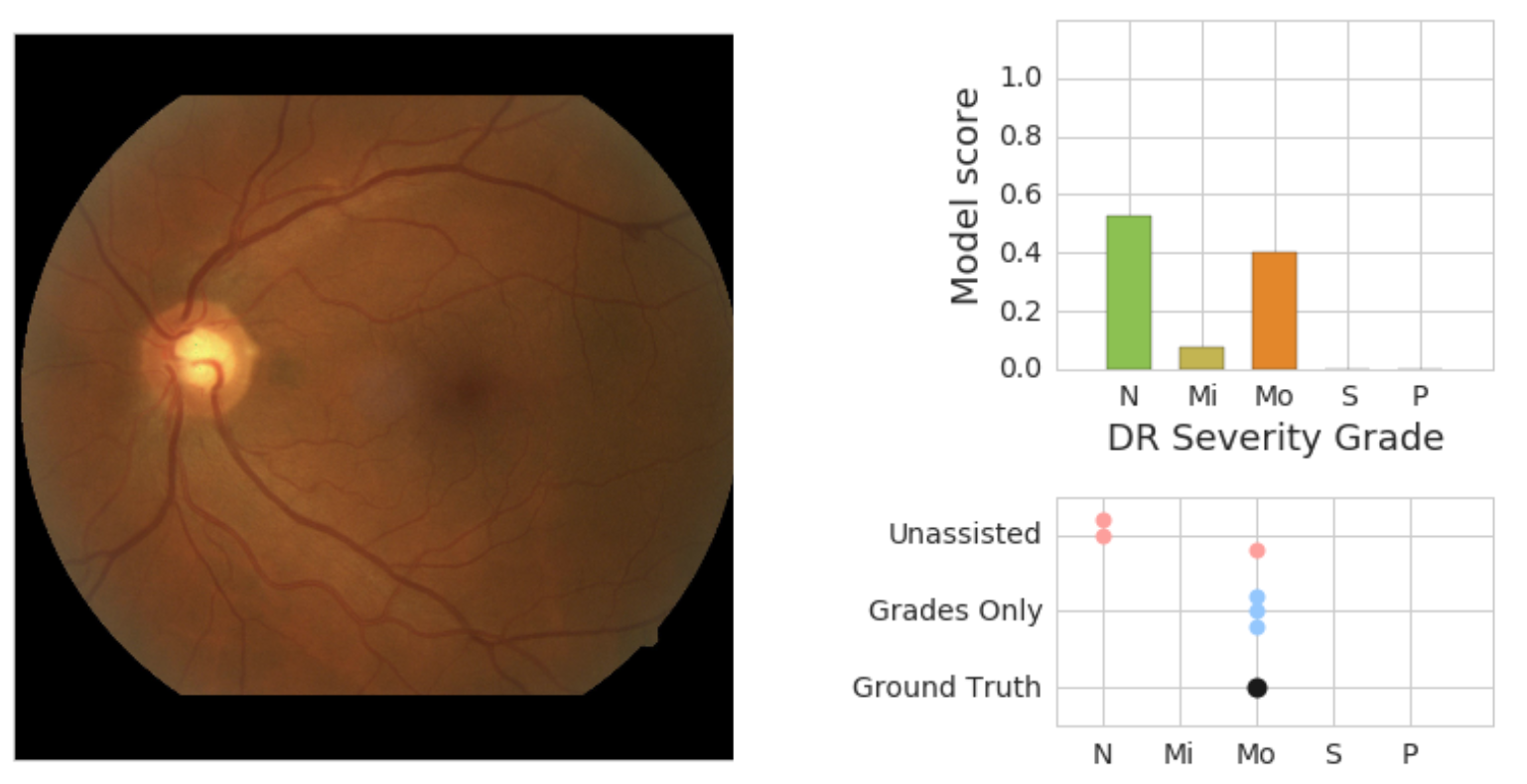 Google retina cheap deep learning