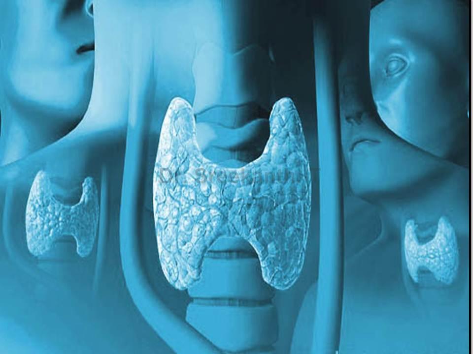 KlinikaAnatomY Thyroid Gland Ppt