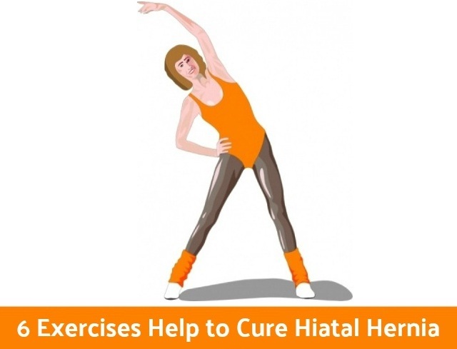 6 Exercises Help to Cure Hiatal Hernia