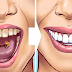 28 EASY TEETH HACKS THAT WORK MAGIC