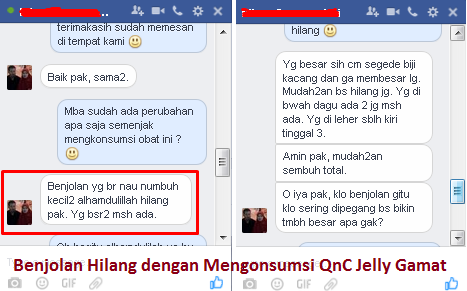 Obat Penyakit Tumor Payudara Di Apotik Obat Penyakit Tumor Payudara Di Apotik