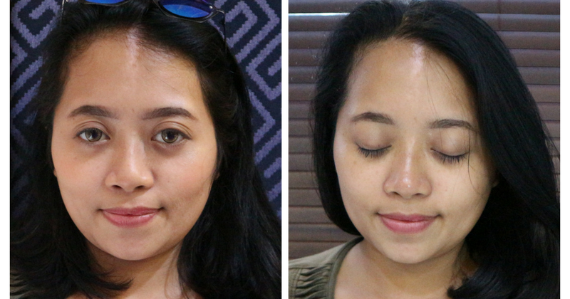 Bali Beauty Blogger Whitening Facial Microdermabrasi Klinik Estetika Dr Affandi