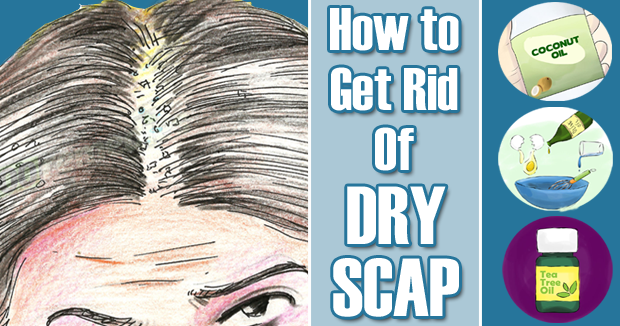 Dry Skin Remedy Natural Food Dry Skin Remedy Natural Food