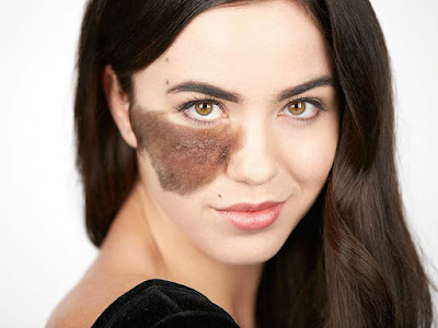 Wanita Cantik Berkulit Aneh Paling Menginspirasi Wanita Cantik Berkulit Aneh Paling Menginspirasi