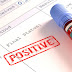 1,086 Nigerians confirmed HIV positive in Nasarawa State