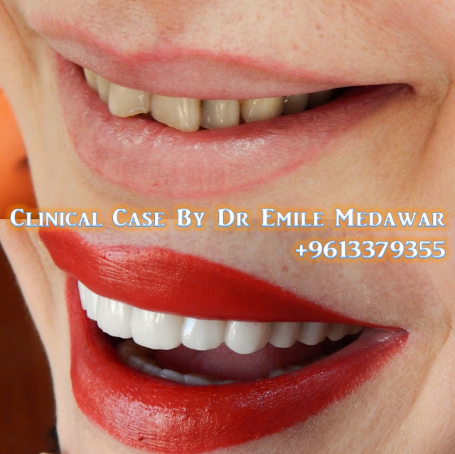 Dr Emile Medawar, Style Dental and Beauty Clinic, 00 961 3 379355
