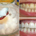 Gargle With One Simple Ingredient And See What Happens To Your Teeth