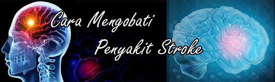 cara mengobati penyakit stroke 100% alami hingga sembuh total cara mengobati penyakit stroke 100% alami hingga sembuh total