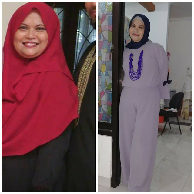 Cara Menghilangkan Jerawat Dengan Teh Hijau