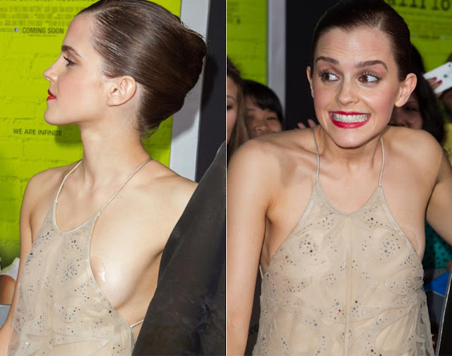 Emma Watson Wardrobe Malfunctions Pics.
