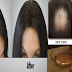 4 Proven And Effective Ways To Treat Hair Fall Without Spending Money