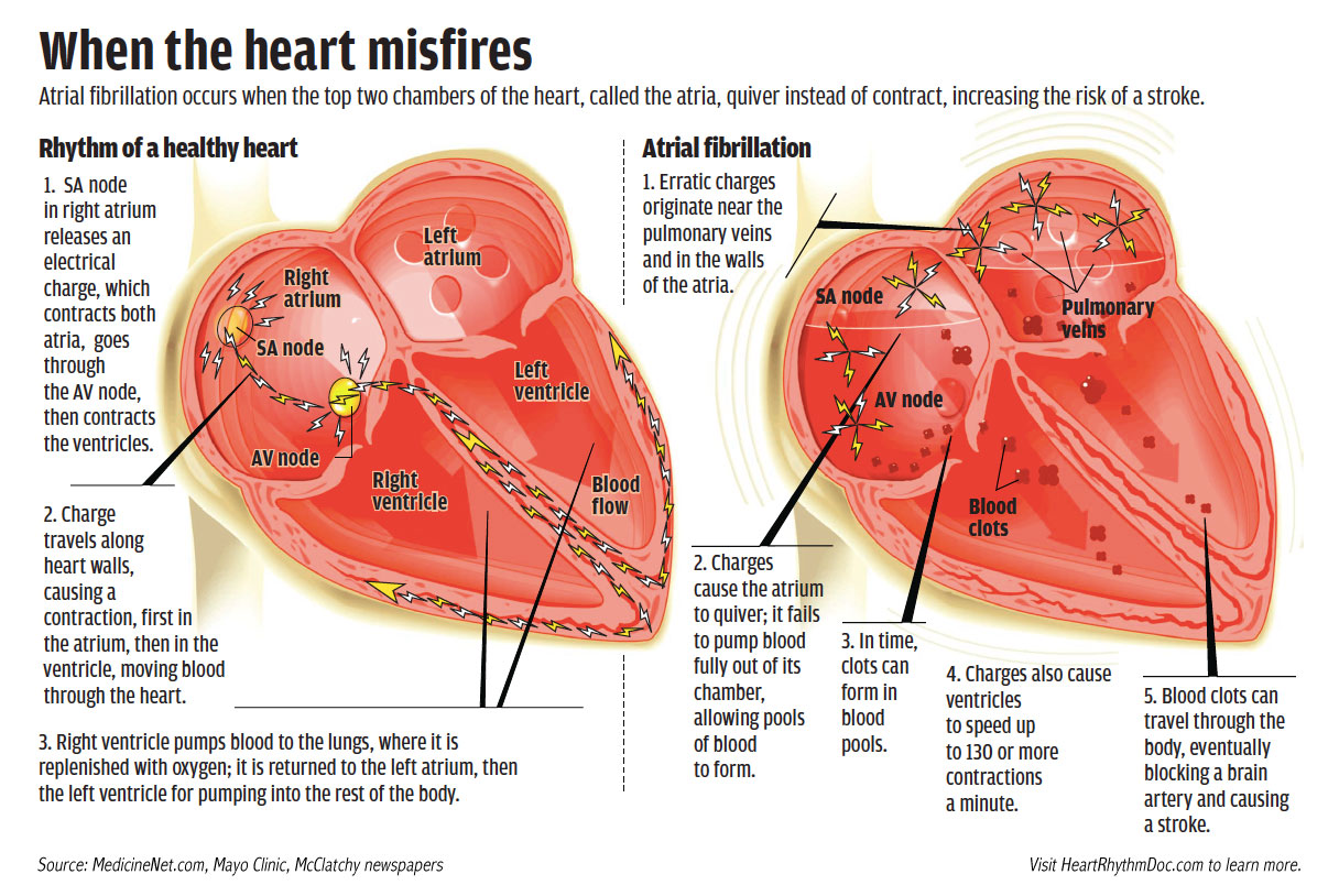 HeartRelated Disease