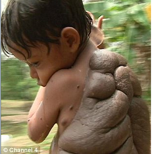 Το παιδί χελώνα The turtle child